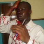 Evidence of police brutality, this is Isaac Kambwiri of capital radio