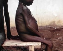 Recent Research Verifies Link Between Gut Biota and Malnutrition by Jay Krishnan
