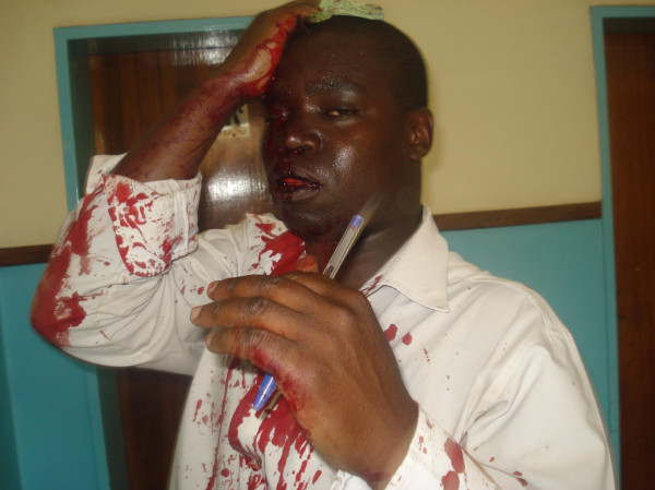 Evidence of Police Brutality during Malawi Demonstrations in July 2011
