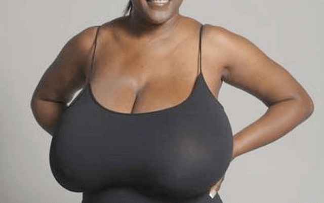 ‘My Breasts Are Killing Me, They Won’t Stop Growing’ Woman Cries Out