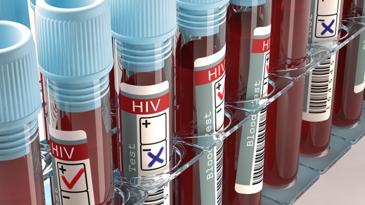 New AIDS Vaccine ‘Cures’ Five Patients, Report Claims