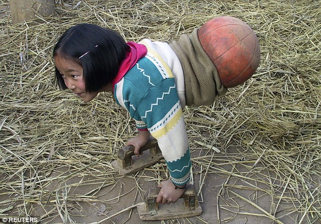 If You Think Your Life Is Miserable, Read The Inspiring Story Of This Girl (Pics & Vid)