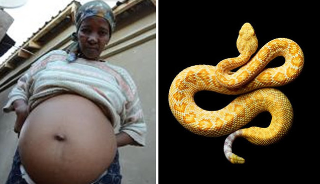 Doctors Find Snake In Woman’s Stomach After Believing She Was Pregnant