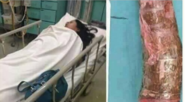 Lady is Hospitalized After Cassava Got Stuck in Her Private Part (photos)