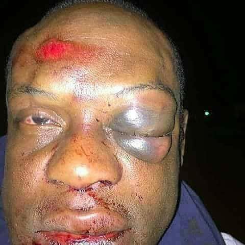 Panel Beaten for Sleeping with a Married Woman