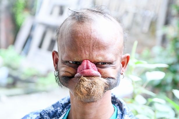 35-year-old man claims he has the longest tongue in the world | Face of  Malawi