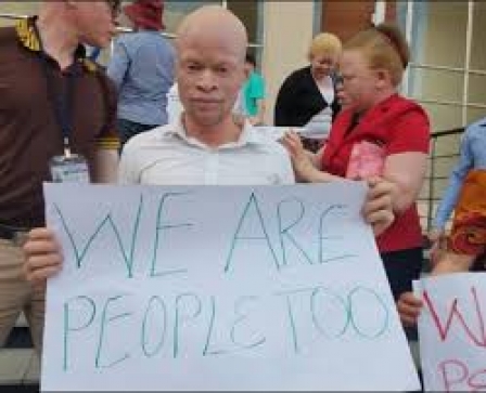 Chiradzulu to host International Albinism Awareness Day on 13th June