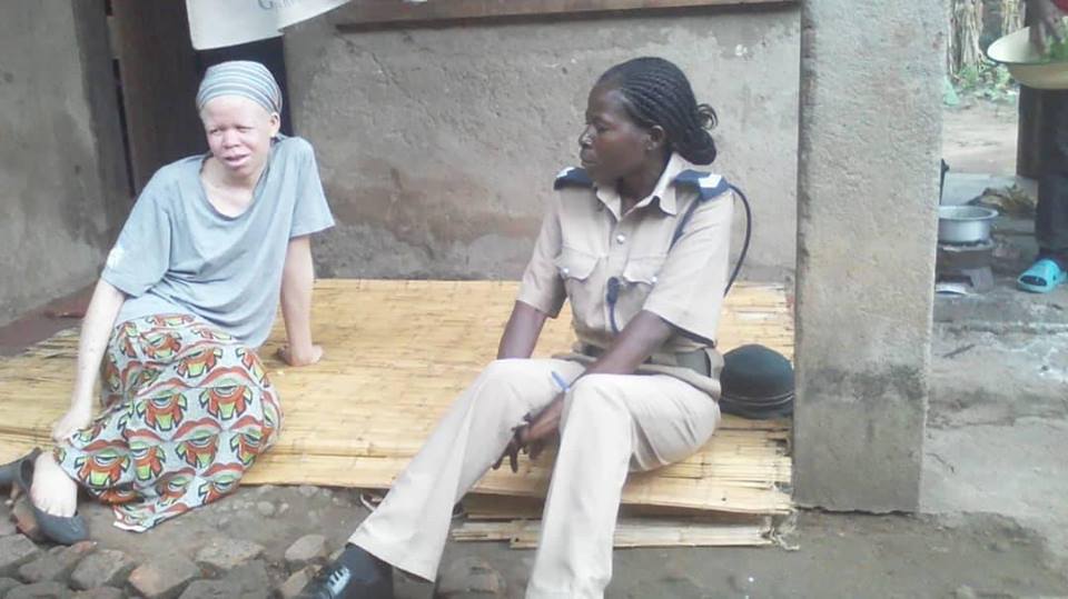 Police in Balaka Embarks on Regular Visit on Persons with Albinism