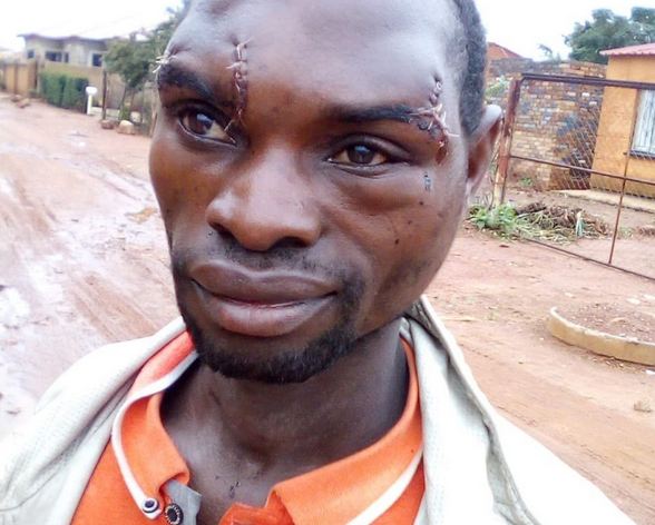 Malawian Man in SA Beaten for Bonking Married Woman
