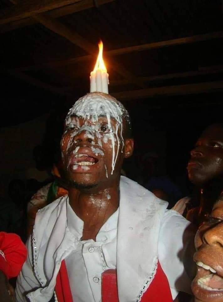 Man Hospitalised after Being Burnt by Candle During Deliverance