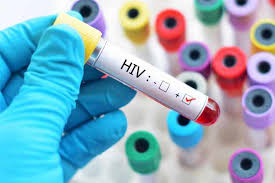 London patient becomes second to be cured of HIV After Undergoing Stem Cell Transplant Treatment