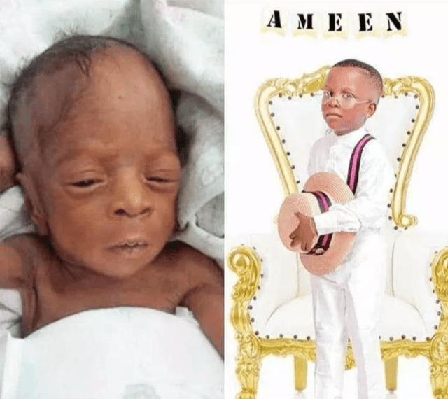Baby Boy Born At 26 Weeks Old Turns 1 Year Old