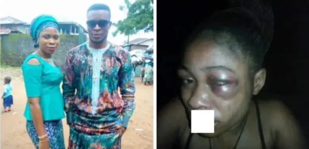 Man brutalizes wife for refusing to abort 3-month-old pregnancy