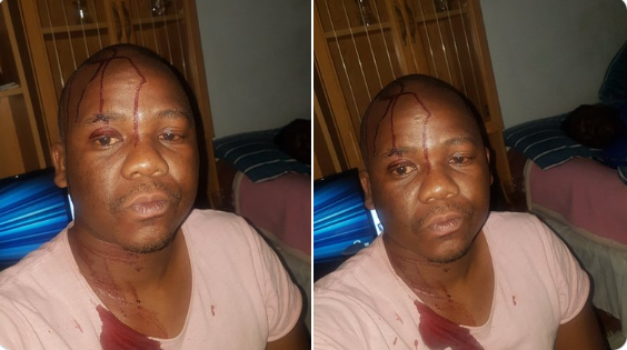 South Africa Gay Man Beaten by Homophobes, Escapes Being Killed
