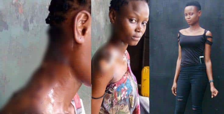 Lady Bathed With Hot Water After She Tried To Separate A Fight
