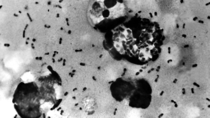 Chinese City Issues An Alert After Confirming A Suspected Case Of Bubonic Plague, A Rare But Serious Bacterial Infection