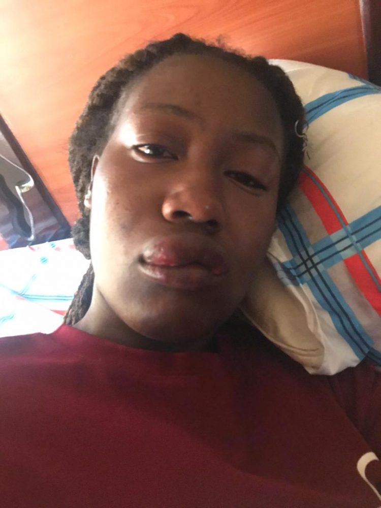 Jilted Lover Attacks Ex-Girlfriend,Leaves Her Toothless