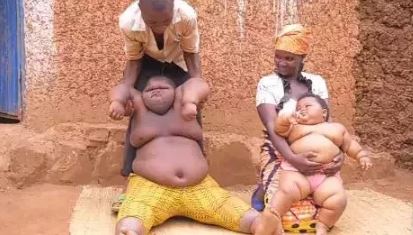 How Did These Children Get So Fat?, Parents Tell Their Story (See Photos)