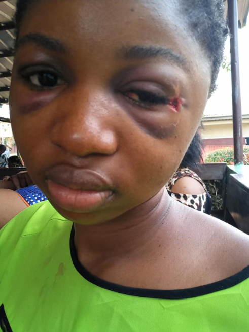 Woman survives 5 days with bullet in her head (See Photos)