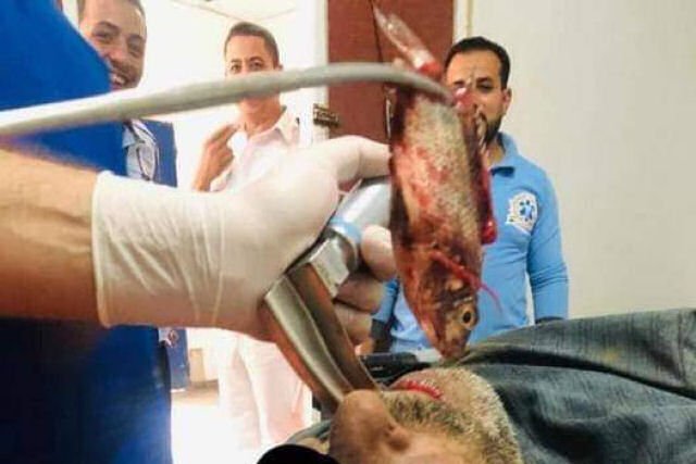 Fisherman Has Live Fish Stuck in His Throat in Bizarre Accident [Video]