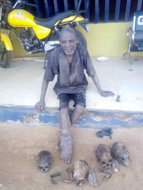 Ritualist Caught With Four Human Skulls, Dried Hands Stolen From Cemetery