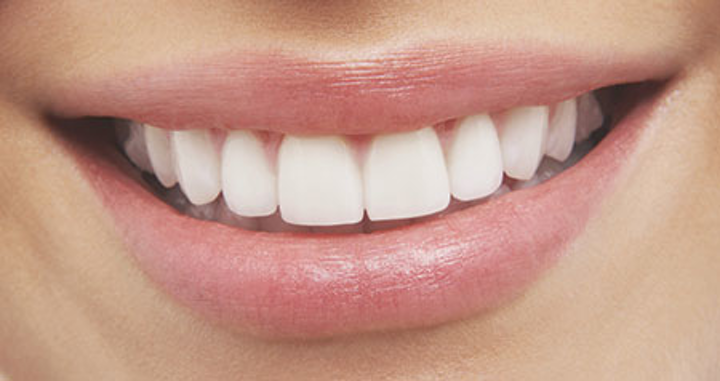 7 Home Remedies for a White and Odorless Teeth