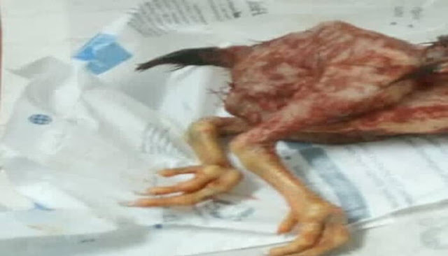 Shocking! Chicken found in the womb of a 29 years old woman after a surgery
