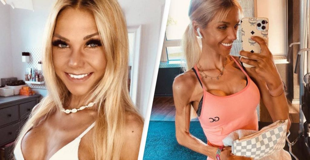 German Instagram influencer Josi Maria dies at 24 after public battle with Anorexia
