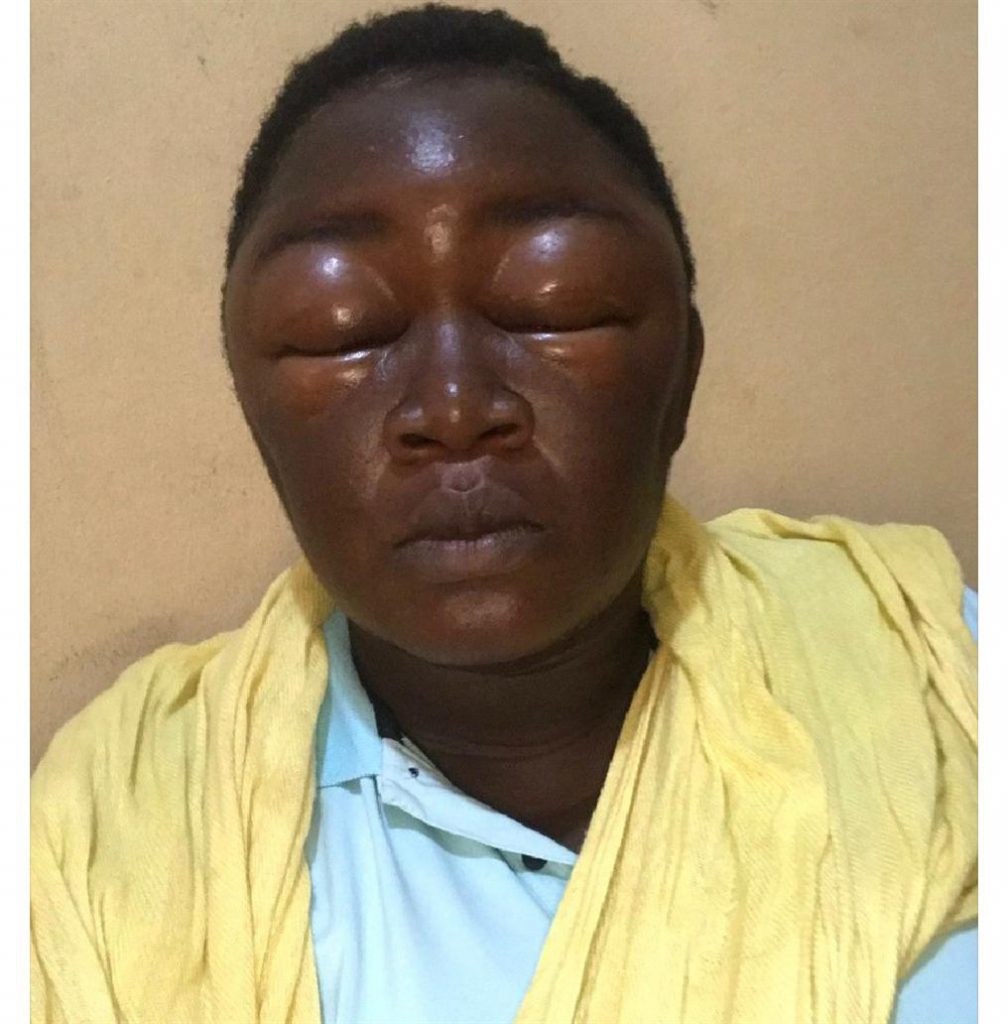 Woman Reveals What Hair Dye Did To Her