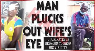 Man Plucks Out Wife’s Eye Accusing Her Of Lacking Respect
