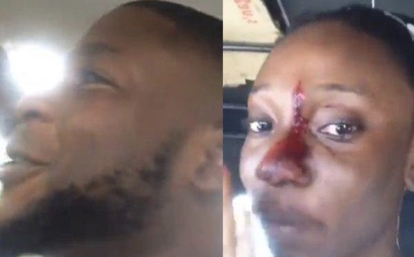 Man Injures Woman For Refusing To Talk To Him Then Boasts That His Girlfriend Is Hotter Than Her [Video]