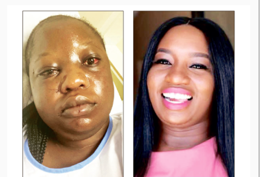 Teacher stabs colleague with kitchen knife over stolen money in principal’s office