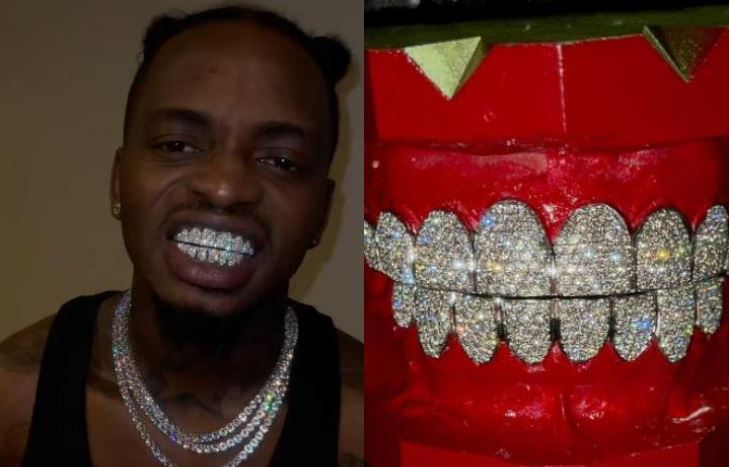 Diamond Platinumz gets new gold-plated teeth