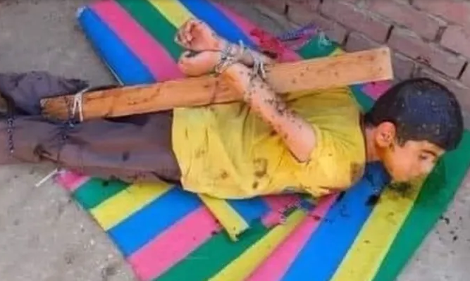 Father Allegedly Tied His seven-Year-Old Son To A Pole And Covered Him With Honey To Attract Bees As A Punishment In Egypt