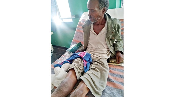 74-year-old man crawls for 8 hours after Elephant crushes his Leg