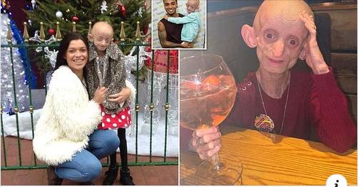 Teen with disease that aged her body to 144 years dies after her 18th birthday