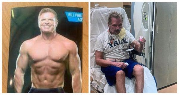 Bill Phillips Covid before and after photos show dramatic deterioration