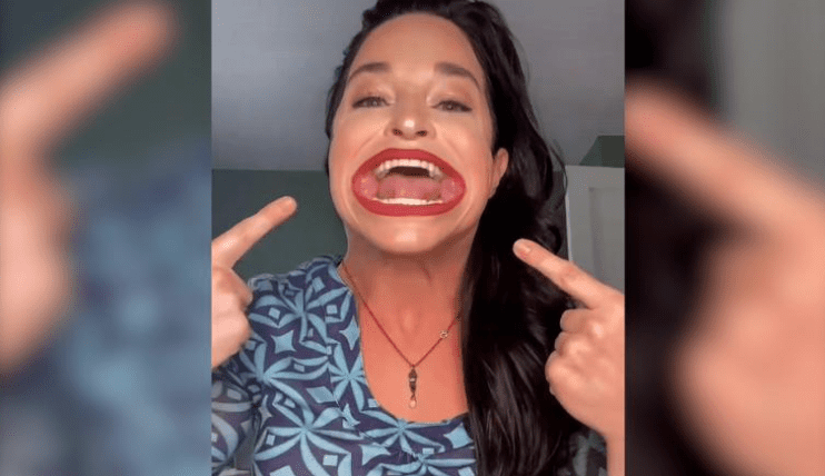 Meet woman with largest mouth in the world,