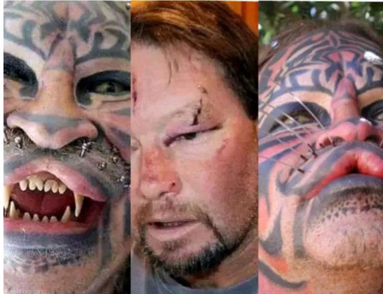 Meet Denis Avner, The Man Who Spent More Than $200,000 On 14 Surgeries To Look Like A Tiger.