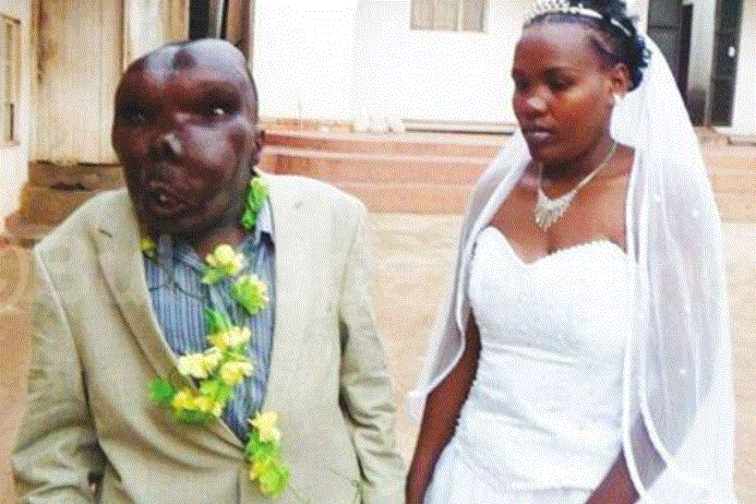 The World’s Ugliest Man Reportedly Marries 3rd Wife (See Pictures)