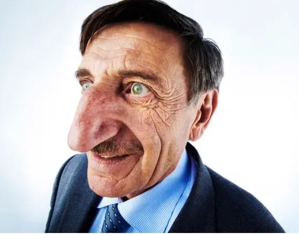 Meet Turkish Man Mehmet Özyürek  Who Has The World’s Largest Nose (See Photos)