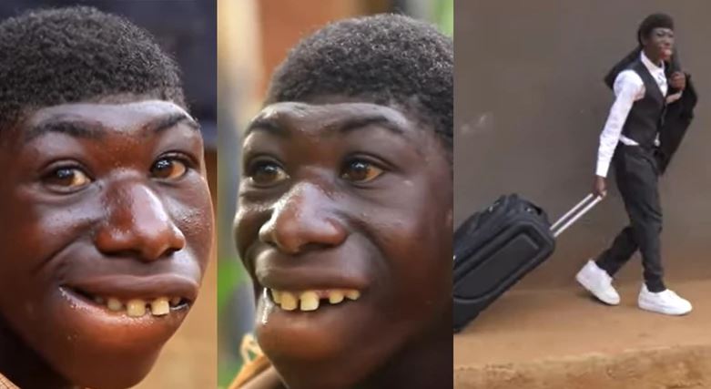 Amazing transformation of 21-year-old man bullied for being born different (watch video)
