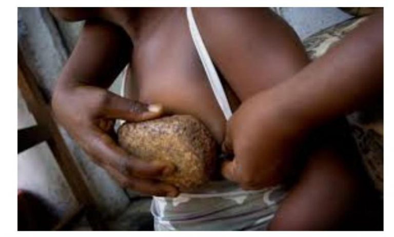 Mothers Iron Their Daughters Breasts To Reduce Attraction