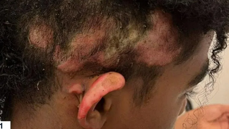 Teenager Is Arrested For Setting Classmate’s Hair On Fire (See Photos)