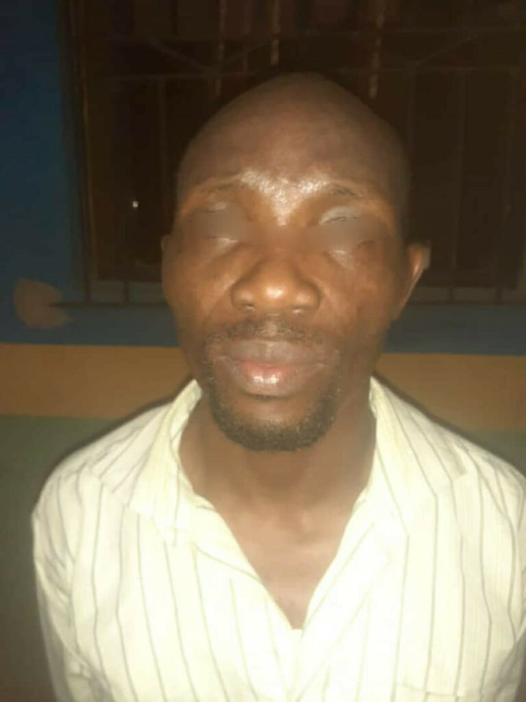 Popular Pastor Arrested For Chewing 19-Year-Old Female Church Member During Deliverance