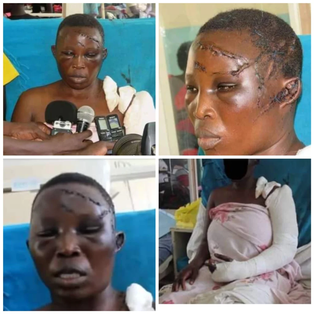 Man hacks Wife with Machete for denying him s3x