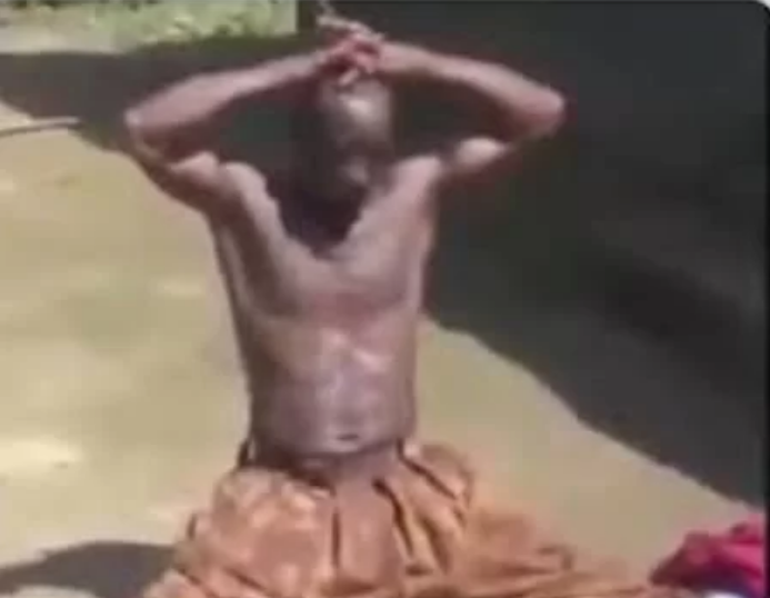 Zambian Man Loses His Balls After Sleeping With Someone’s Wife