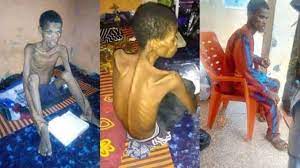 Man Almost Dies After Fasting For 40 Days And 40 Nights