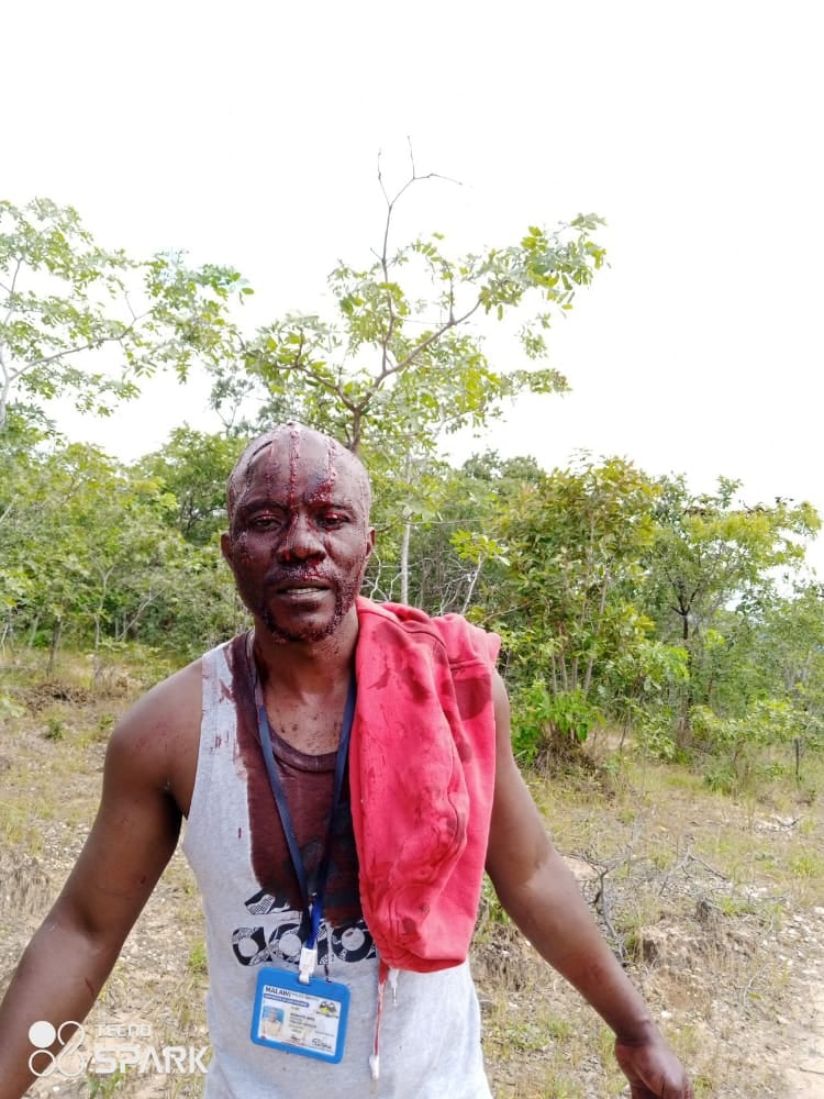 Police officer hacked by angry villagers in Mzimba