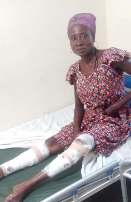 Ghanaian Man Slashes His 56-Yr-Old Girlfriend Multiple Times With Machete For Denying Him Sex